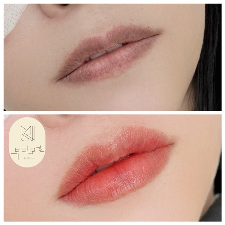 세종시입술문신 칙칙하고 어두운 입술을 워터풀시럽립 기법으로 밝고 화사하게 톤업